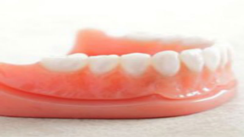 Create a Great Smile Using an Implant Dentist in St. Louis