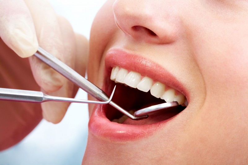 Advantages of Dental Crowns in Toronto