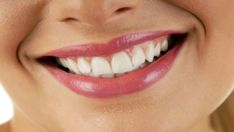 Improve Tooth Appearance with Restorative Dental Bonding in Toms River, NJ