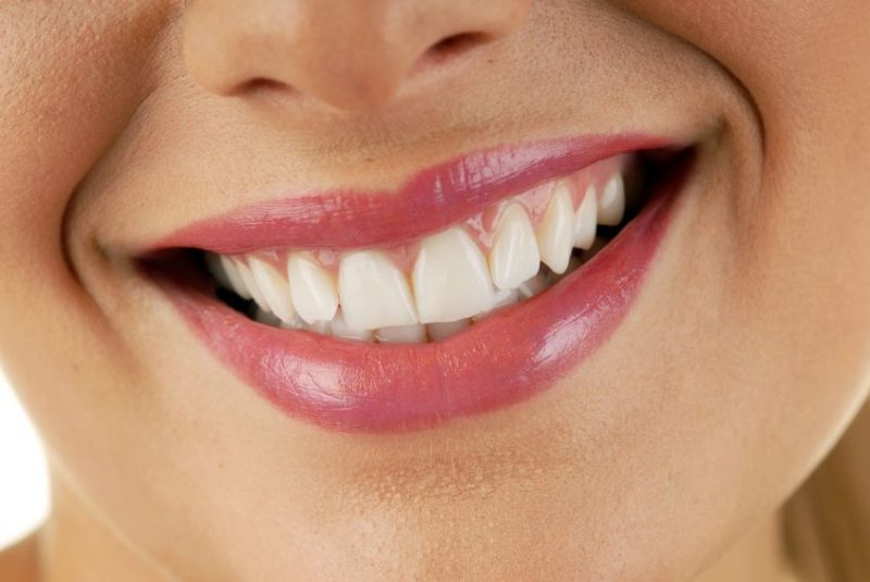 The Most Popular Services Performed By A Cosmetic Dentist In Ocala