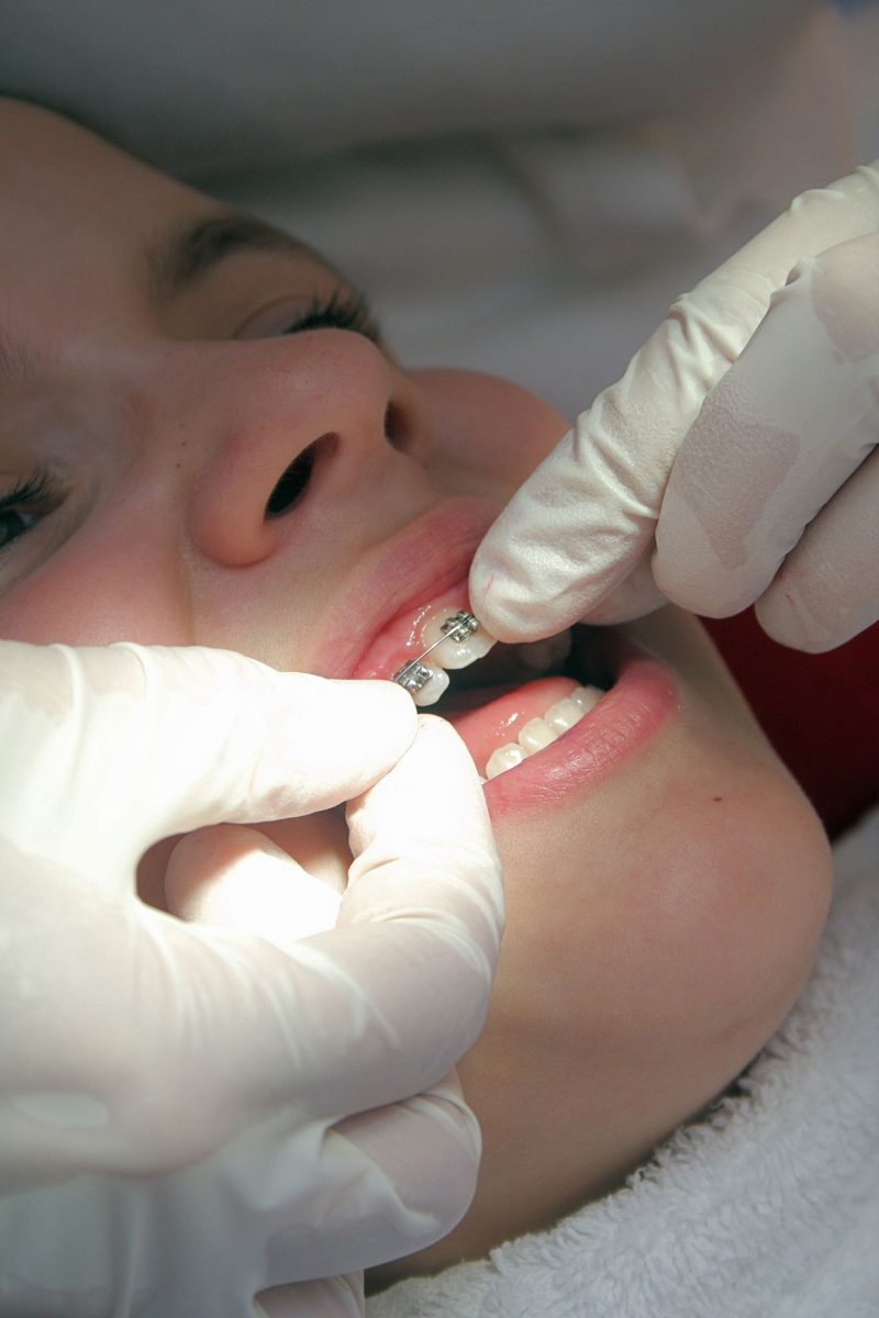 3 Signs You Need a New Dental Crown