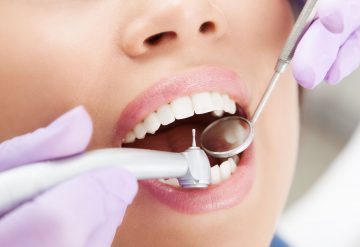 Cosmetic Dentist In Hill District: Benefits