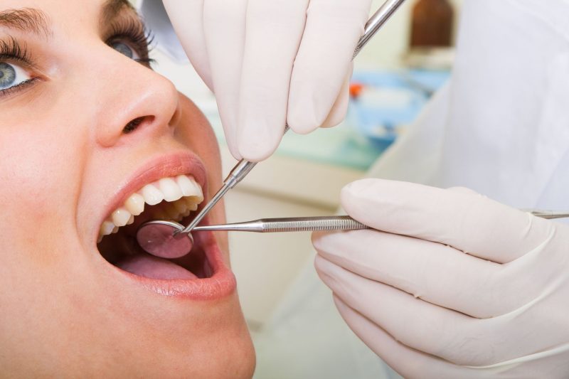Why Consider Professional Bleeding Gums Treatment