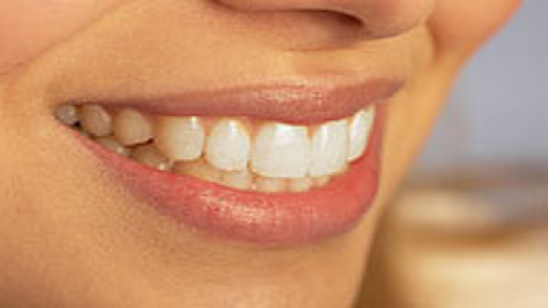 How to Select a Sedation Dentist