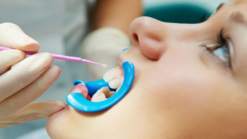 What Should Parents Know About Sedation Dentistry in Broken Arrow OK?