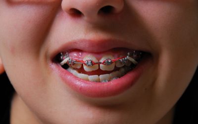 Orthodontist In Parma OH Services That Make Adult And Teen Braces Easy And Effective